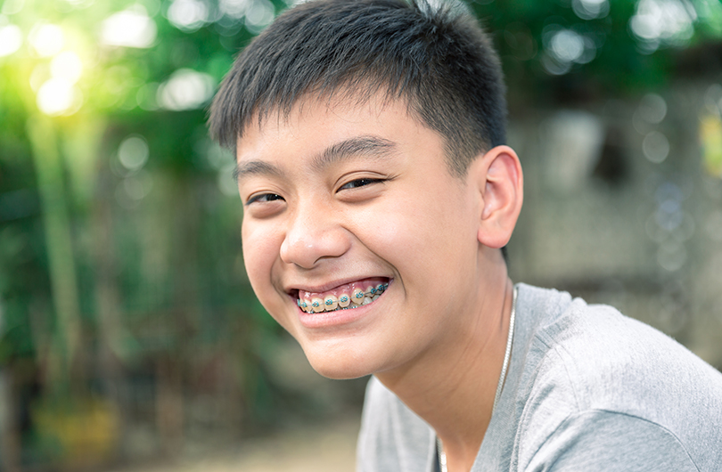 Kids Orthodontics for Braces